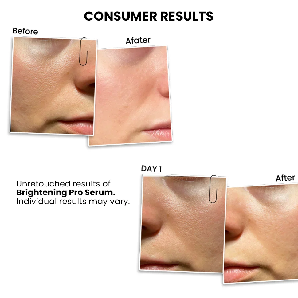 Kojic Acid Brightening PRO Face Serum with Alpha Arbutin & Diacnemide™ - 30 ml - Image 11