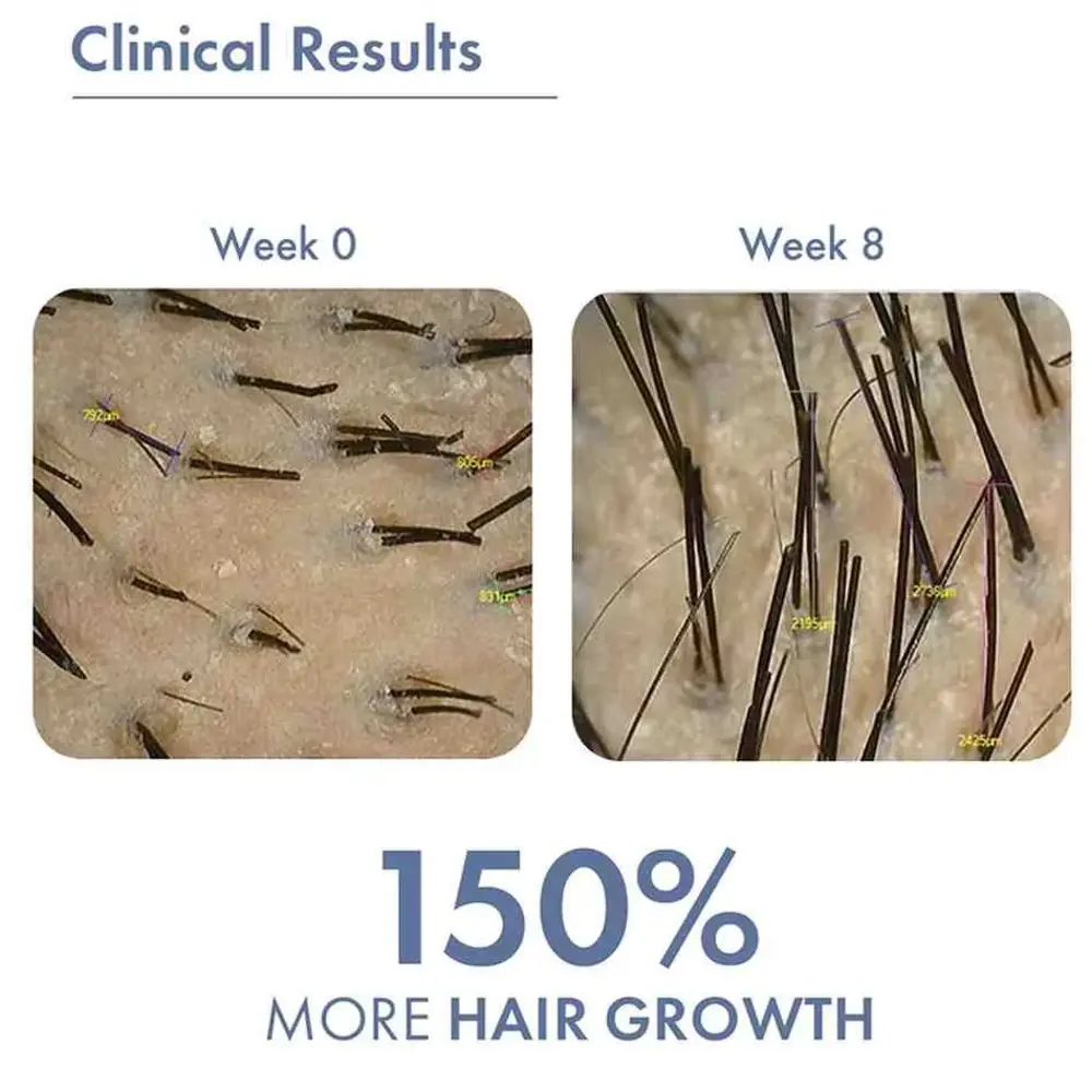 Hair Growth Serum 2.0 For Men & Women, 50ml - Image 5