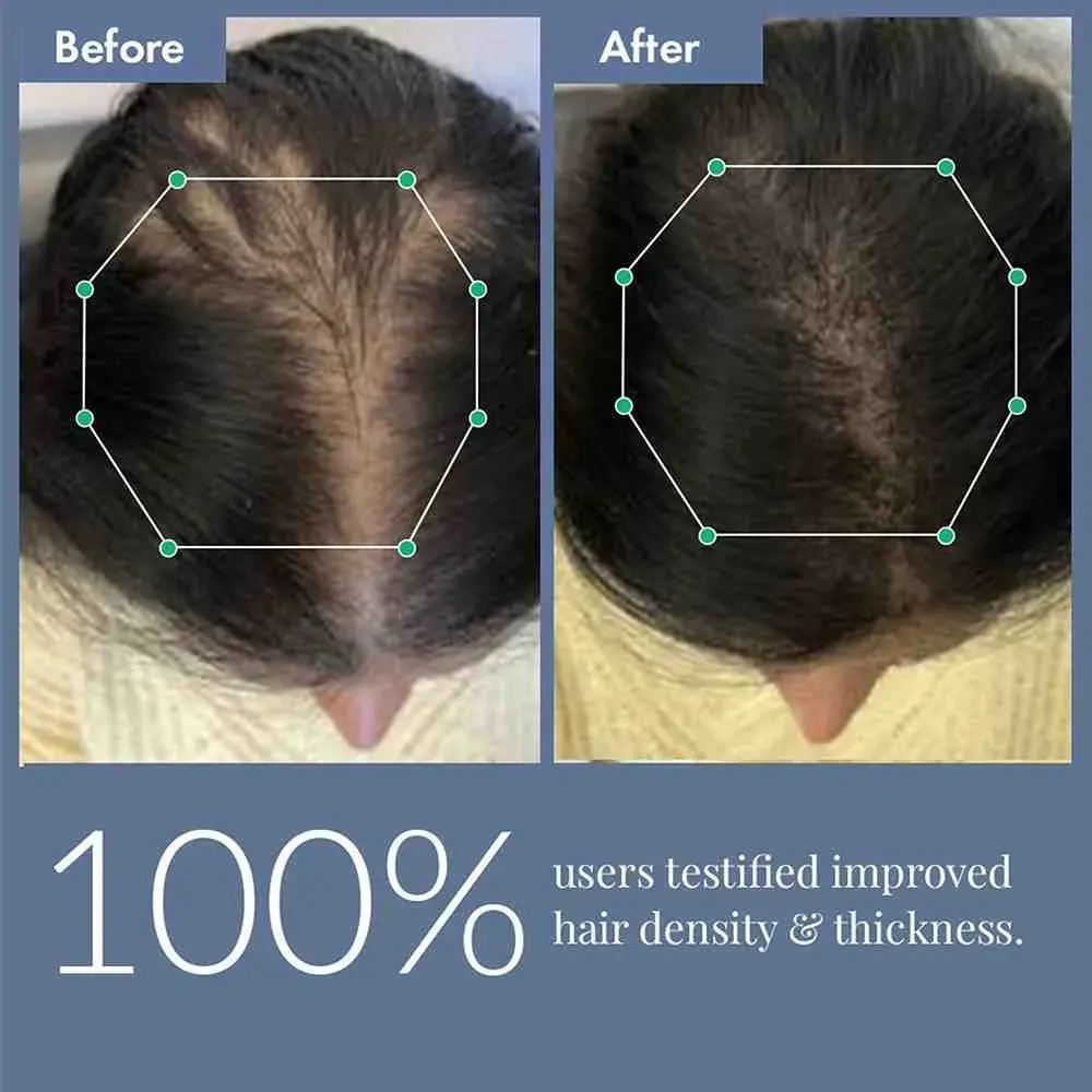 Hair Growth Serum 2.0 For Men & Women, 50ml - Image 7