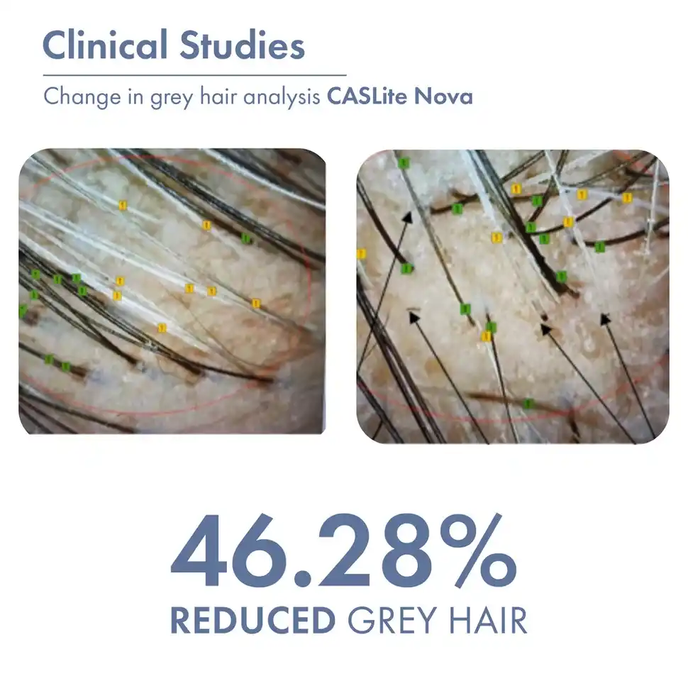 Anti-Grey Hair Prime Serum - Image 5