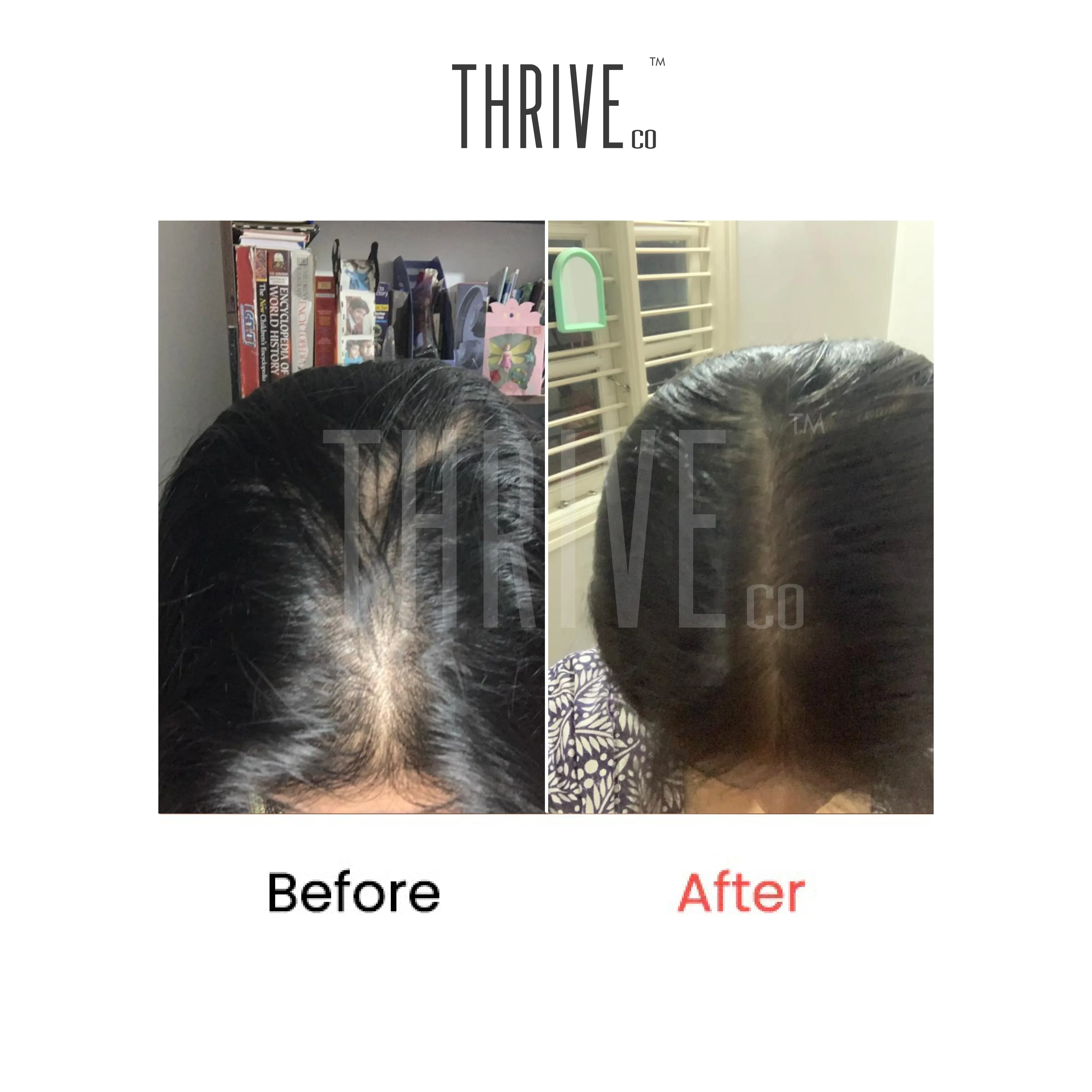 Hair Growth Serum (50ml) + Scalp Exfoliating Scrub (100ml) - Image 2