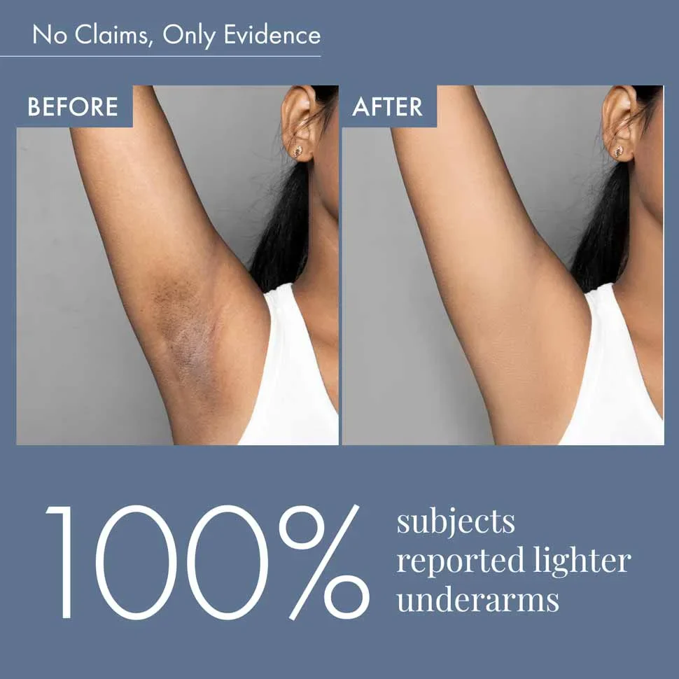 Underarm Lightening Roll on- Pack Of 3 - Image 6